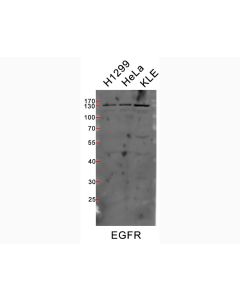 Bulk Anti-Human EGFR (EGFR.1) Antibody