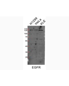 Bulk Anti-Human EGFR (EGFR.1) Antibody