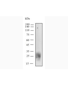 Anti-Mouse CTLA-4 (UC10-4F10-11) In Vivo Antibody - Low Endotoxin