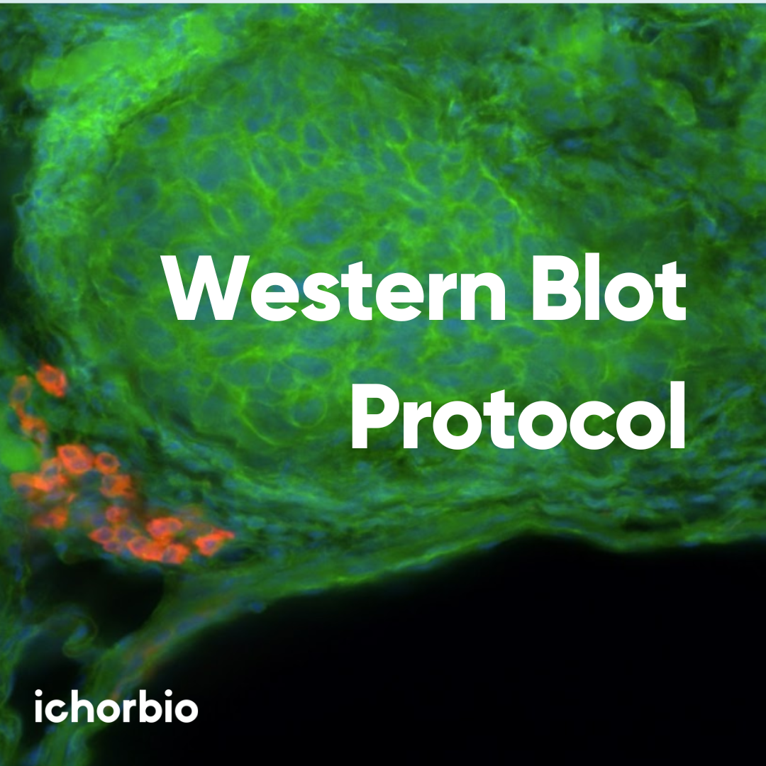 Western Blot Standard Protocol